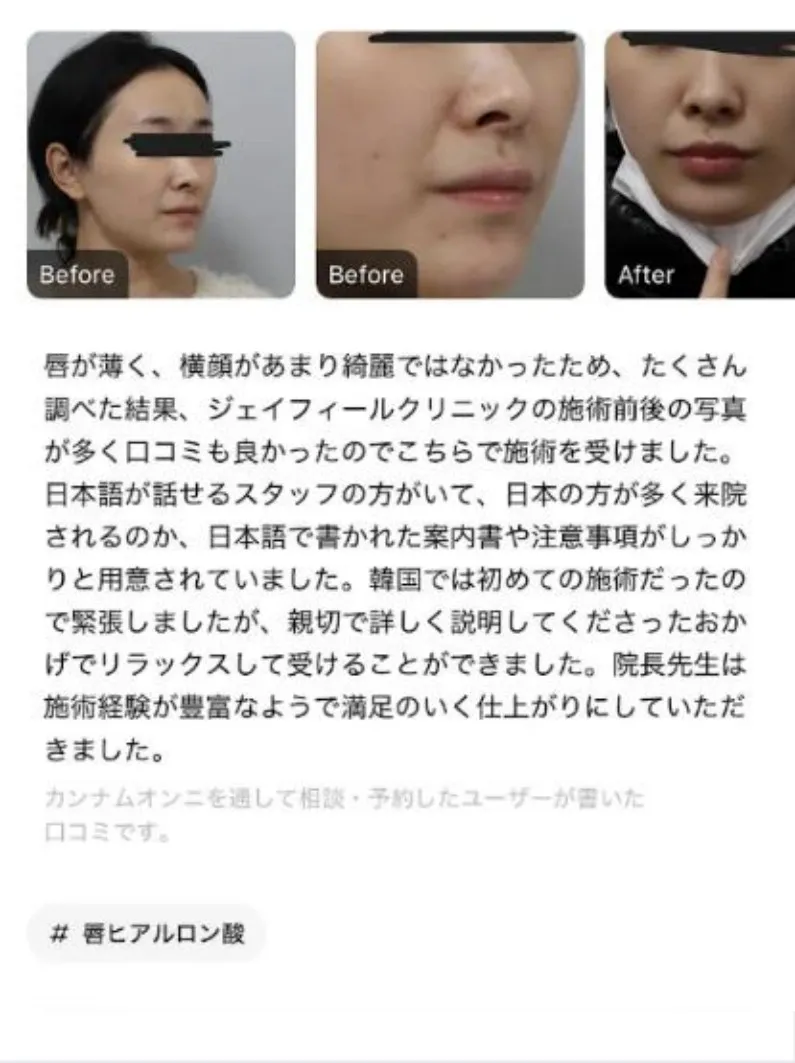 강남언니 리뷰 2