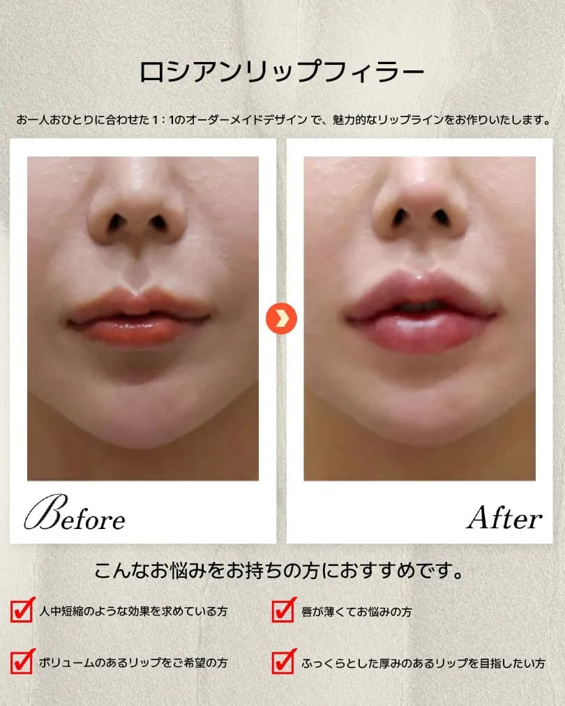 下颌线·嘴唇·牙科 Before & After — Dasion 医院