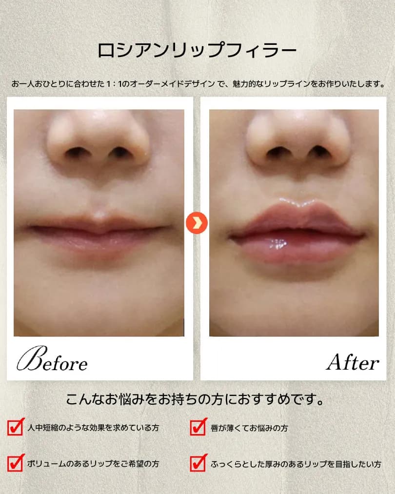 下颌线·嘴唇·牙科 Before & After — Dasion 医院
