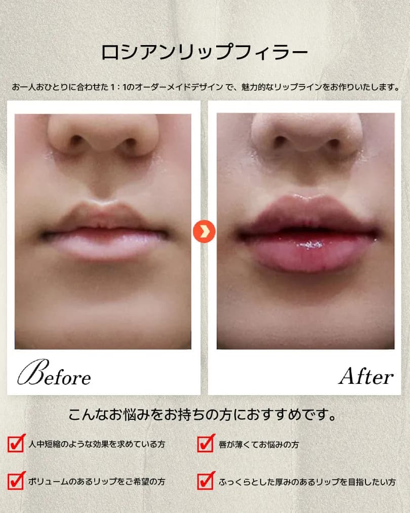 下颌线·嘴唇·牙科 Before & After — Dasion 医院